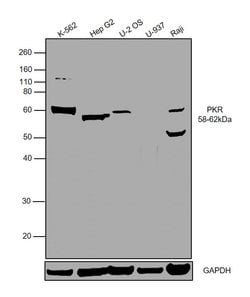 Invitrogen PKLR Polyclonal Antibody 100 &mu;L | Buy Online | Invitrogen&trade; | Fisher Scientific