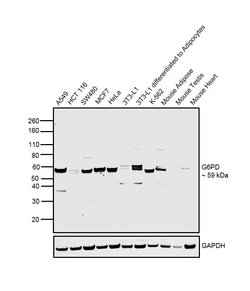 Invitrogen G6PD Polyclonal Antibody 100 &mu;L; Unconjugated:Antibodies,