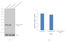 Adenosine Kinase Polyclonal Antibody, Invitrogen 100 &mu;L; Unconjugated:Antibodies,