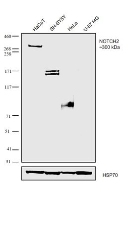 Invitrogen NOTCH2 Polyclonal Antibody 100 &mu;L; Unconjugated:Anticuerpos