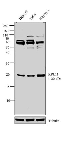 Invitrogen RPL11 Polyclonal Antibody 100 μL; Unconjugated:Antibodies,