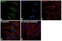 ATP5A1 Polyclonal Antibody:Antibodies, Polyclonal