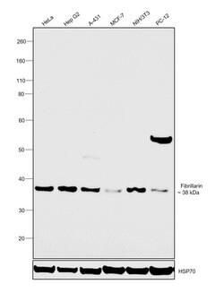 Invitrogen Fibrillarin Polyclonal Antibody 100 &mu;L; Unconjugated:Antibodies,