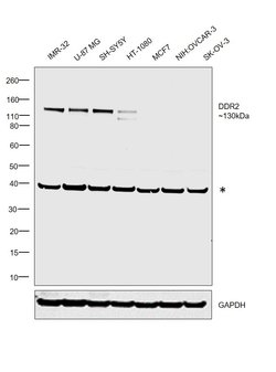 Invitrogen DDR2 Polyclonal Antibody 100 &mu;L; Unconjugated:Antibodies,