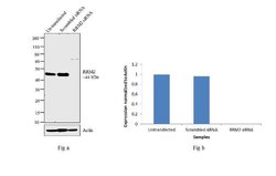 Invitrogen RRM2 Polyclonal Antibody 100 &mu;L; Unconjugated:Antibodies,
