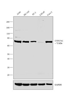 Invitrogen CYP27A1 Polyclonal Antibody 100 μL; Unconjugated:Antibodies,