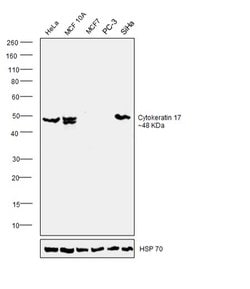 Invitrogen Cytokeratin 17 Polyclonal Antibody 100 &mu;L; Unconjugated:Antibodies,