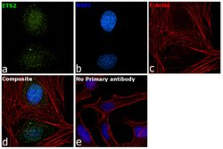 Invitrogen ETS2 Polyclonal Antibody 100 &mu;L; Unconjugated:Antibodies,