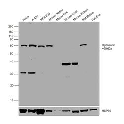 Optineurin Polyclonal Antibody:Antibodies, Polyclonal