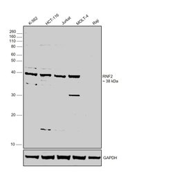 Invitrogen RNF2 Polyclonal Antibody 100 &mu;L | Buy Online | Invitrogen&trade; | Fisher Scientific