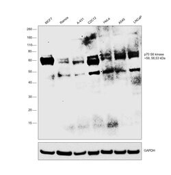 Invitrogen p70 S6 Kinase Polyclonal Antibody 100 &mu;L; Unconjugated:Antibodies,