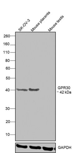 Invitrogen GPR30 Polyclonal Antibody 100 &mu;L | Buy Online | Invitrogen&trade; | Fisher Scientific