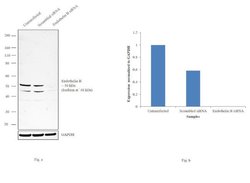Endothelin B Receptor Polyclonal Antibody, Invitrogen 100 &mu;L; Unconjugated:Antikroppar