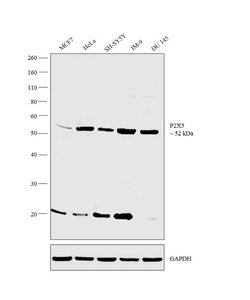 P2X5 Polyclonal Antibody, Invitrogen 100 μL; Unconjugated:Antibodies,