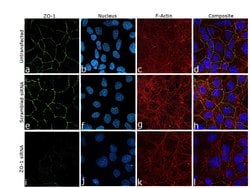 Invitrogen ZO-1 Polyclonal Antibody 100 μL; Unconjugated:Antibodies,