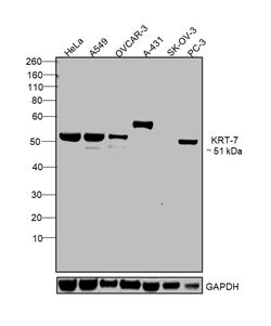 Invitrogen Cytokeratin 7 Polyclonal Antibody 100 &mu;L; Unconjugated:Antibodies,