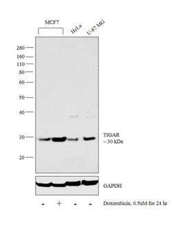 Invitrogen TIGAR Polyclonal Antibody 100 &mu;L; Unconjugated:Antibodies,