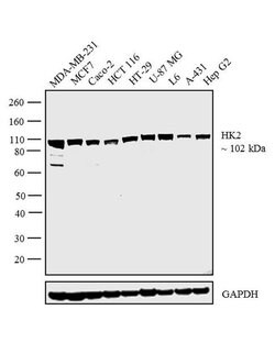 Invitrogen HK2 Polyclonal Antibody 100 &mu;L; Unconjugated:Antibodies,