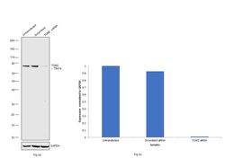 Invitrogen TGM2 Polyclonal Antibody 100 &mu;L; Unconjugated:Antibodies,