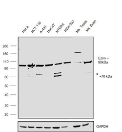 Invitrogen Ezrin Polyclonal Antibody 100 &mu;L; Unconjugated:Antibodies,