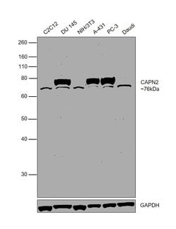 Invitrogen Calpain 2 Polyclonal Antibody 100 &mu;L | Buy Online | Invitrogen&trade; | Fisher Scientific