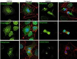 Invitrogen CEP55 Polyclonal Antibody 100 &mu;L; Unconjugated:Antibodies,