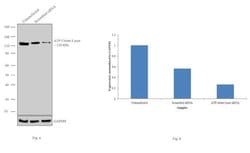 Invitrogen ATP Citrate Lyase Polyclonal Antibody 100 &mu;L; Unconjugated:Antibodies,