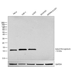 Invitrogen beta-2 Microglobulin Polyclonal Antibody 100 &mu;L; Unconjugated:Antibodies,