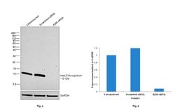 Invitrogen beta-2 Microglobulin Polyclonal Antibody 100 &mu;L; Unconjugated:Antibodies,