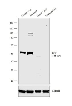 Invitrogen GPT Polyclonal Antibody 100 &mu;L; Unconjugated:Antibodies,