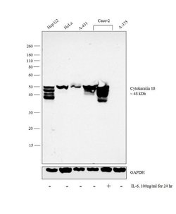 Invitrogen Cytokeratin 18 Polyclonal Antibody 100 &mu;L; Unconjugated:Antibodies,