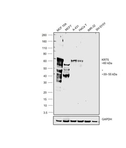 Invitrogen Cytokeratin 5 Polyclonal Antibody 100 &mu;L; Unconjugated:Antibodies,