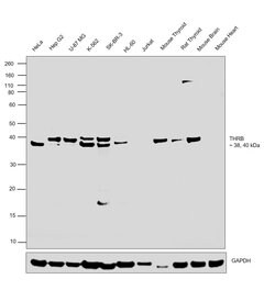 Invitrogen THRB Polyclonal Antibody 100 &mu;L; Unconjugated:Antibodies,