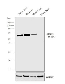 Invitrogen ALDH2 Polyclonal Antibody 100 &mu;L; Unconjugated:Antibodies,
