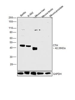 Invitrogen CTH Polyclonal Antibody 100 &mu;L | Buy Online | Invitrogen&trade; | Fisher Scientific