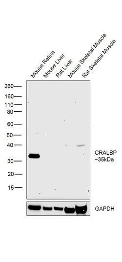Invitrogen CRALBP Polyclonal Antibody 100 &mu;L; Unconjugated:Antibodies,