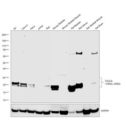 Invitrogen TAGLN Polyclonal Antibody 100 &mu;L; Unconjugated:Antibodies,