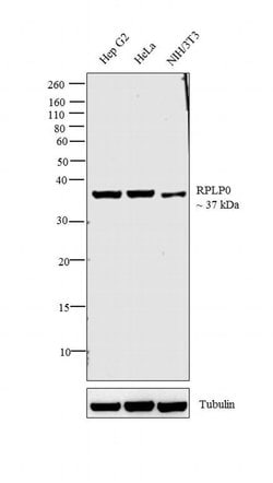 Invitrogen RPLP0 Polyclonal Antibody 100 &mu;L; Unconjugated:Antibodies,