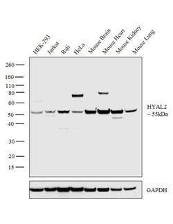 Invitrogen HYAL2 Polyclonal Antibody 100 &mu;L; Unconjugated:Antibodies,