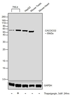 Invitrogen CALCOCO2 Polyclonal Antibody 100 &mu;L; Unconjugated:Antibodies,