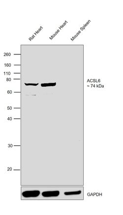 Invitrogen ACSL6 Polyclonal Antibody 100 μL; Unconjugated:Antibodies,