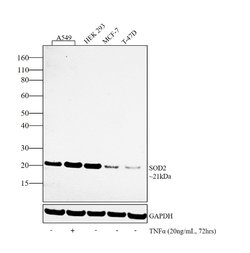 Invitrogen SOD2 Polyclonal Antibody 100 &mu;L | Buy Online | Invitrogen&trade; | Fisher Scientific