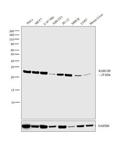Invitrogen RAB33B Polyclonal Antibody 100 &mu;L; Unconjugated:Antibodies,
