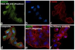 Invitrogen Galectin 1 Polyclonal Antibody 100 &mu;L; Unconjugated:Antibodies,