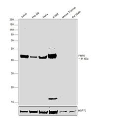 Invitrogen PHF6 Polyclonal Antibody 100 &mu;L; Unconjugated:Antibodies,