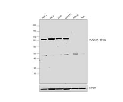 Invitrogen PLA2G4A Polyclonal Antibody 100 &mu;L; Unconjugated:Antibodies,