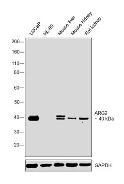 Invitrogen Arginase 2 Polyclonal Antibody 100 &mu;L; Unconjugated:Antibodies,