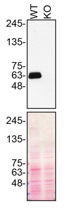 Invitrogen SMOC1 Polyclonal Antibody 100 &mu;L; Unconjugated:Antibodies,