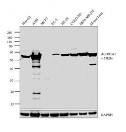 Invitrogen ALDH1A1 Polyclonal Antibody 100 &mu;L | Buy Online | Invitrogen&trade; | Fisher Scientific