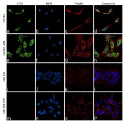 Invitrogen CTGF Polyclonal Antibody 100 &mu;L; Unconjugated:Antibodies,